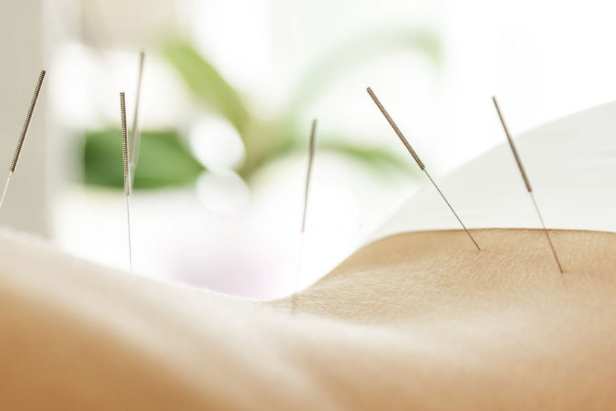 Prática de acupuntura não é exclusiva de médicos, defende MPF