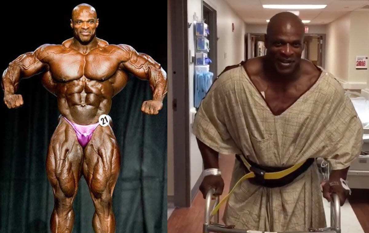 Quantas cirurgias Ronnie Coleman tem?