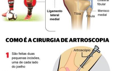 Flamengo perde Arrascaeta por lesão no joelho