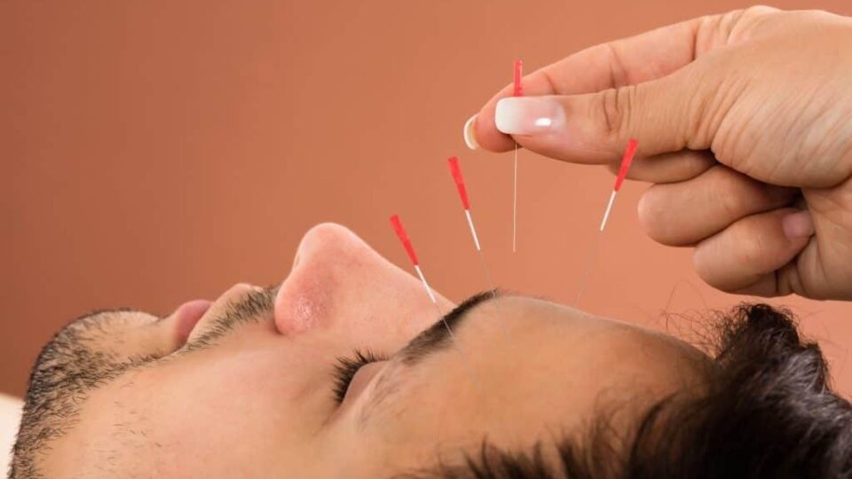 Tratamento da insônia com a acupuntura