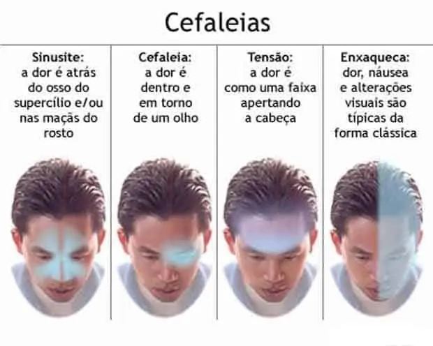 7 Tipos De Dor De Cabeca