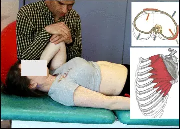 Tratamento Da Escoliose Abordagem De Lyon 14
