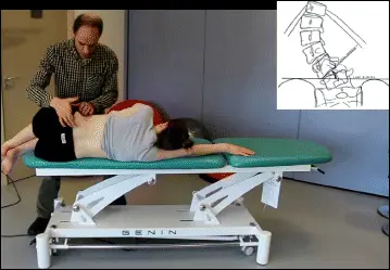 Tratamento Da Escoliose Abordagem De Lyon 15