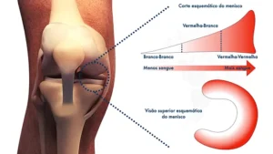 Meniscos Vascularizacao