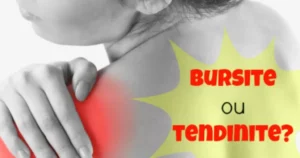 Tendinite Bursite